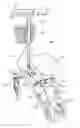 Fig. 01 - Knee-walker