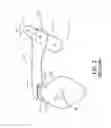 Fig. 03 - Mechanically initiated speed-based latch device