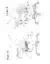 Fig. 02 - Therapeutic back support and stabilization