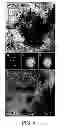 Fig. 05 - Plasma-generating device