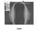 Fig. 35 - Position detecting device