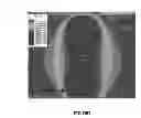 Fig. 37 - Position detecting device