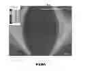 Fig. 41 - Position detecting device