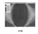 Fig. 44 - Position detecting device