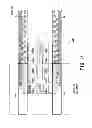 Fig. 12 - Magnetic resonance imaging apparatus and bed device