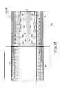 Fig. 22 - Magnetic resonance imaging apparatus and bed device