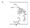 Fig. 01 - Flight deck display of predefined MPA approach paths with differentiated assigned approach path