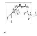 Fig. 03 - Flight deck display of predefined MPA approach paths with differentiated assigned approach path