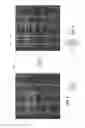 Fig. 04 - System, method and computed readable medium for evaluating a parameter of a feature having nano-metric dimensions