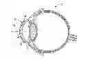 Fig. 01 - CONTACT LENS AND MANUFACTURING METHOD THEREOF
