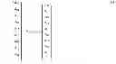 Fig. 81 - Method for calculating and optimizing an eyeglass lens taking into consideration higher-order imaging errors