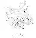 Fig. 06 - Co-located gimbal-based dual stage actuation disk drive suspensions with dampers