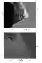 Fig. 11 - Article of manufacture with micro-features of differing surface roughness