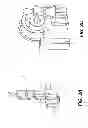 Fig. 03 - Extremity imaging apparatus for cone beam computed tomography