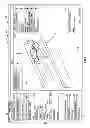 Fig. 06 - Dual display CT scanner user interface