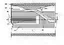Fig. 01 - Systems for correcting distortions in a medical image and methods of use thereof