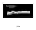 Fig. 08 - Systems for correcting distortions in a medical image and methods of use thereof