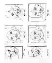 Fig. 07 - Adjusting a contour by a shape model