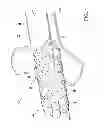 Fig. 02 - Methods of making and accessing cables having access features