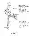 Fig. 02 - Botulinum toxin treatment of anxiety and bipolar disorders