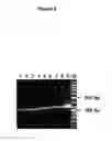 Fig. 02 - Methods for treating juvenile arthritis with ant-bile salt-stimulated lipase (BSSL) antibodies