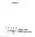 Fig. 03 - Methods for treating juvenile arthritis with ant-bile salt-stimulated lipase (BSSL) antibodies