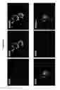 Fig. 06 - Methods for treating juvenile arthritis with ant-bile salt-stimulated lipase (BSSL) antibodies