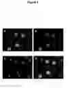 Fig. 07 - Methods for treating juvenile arthritis with ant-bile salt-stimulated lipase (BSSL) antibodies