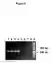 Fig. 10 - Methods for treating juvenile arthritis with ant-bile salt-stimulated lipase (BSSL) antibodies