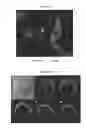 Fig. 43 - HERV-K antigens, antibodies, and methods