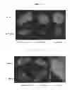 Fig. 55 - HERV-K antigens, antibodies, and methods