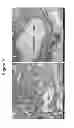 Fig. 98 - HERV-K antigens, antibodies, and methods