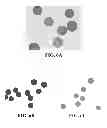 Fig. 07 - Bioresorbable embolization microspheres