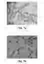 Fig. 08 - Bioresorbable embolization microspheres