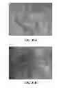 Fig. 33 - Bioresorbable embolization microspheres