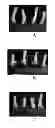 Fig. 01 - Composition for sealing a colorant to a surface, protecting a surface, and providing wear resistance to a surface