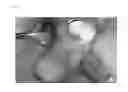 Fig. 09 - Bone carving tool for creating convex ridge for inner border of initial hole for placement of implant hole