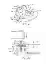 Fig. 04 - Cradle for positioning a final dental prosthesis and a system incorporating the cradle