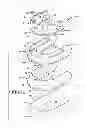 Fig. 02 - Method of installing a final dental prosthesis
