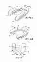 Fig. 03 - Method of installing a final dental prosthesis