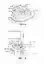 Fig. 04 - Method of installing a final dental prosthesis