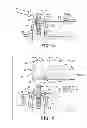 Fig. 06 - Method of installing a final dental prosthesis