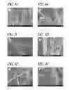 Fig. 06 - Methods for isolating vesicles from biological fluids
