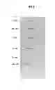 Fig. 02 - Method for preparing polymeric protein composed of monomeric protein produced by fusing protein having immunoglobulin fold structure to protein capable of serving as subunit structure