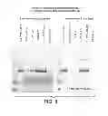 Fig. 07 - THERMOLYSIN VARIANTS AND DETERGENT COMPOSITIONS THEREWITH