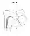 Fig. 07 - Sheet folding device having sheet retaining mechanism