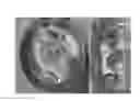 Fig. 07 - Seed Coating Hydrogels