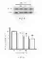 Fig. 06 - METHOD OF THERAPY AND DIAGNOSIS OF ATHEROSCLEROSIS