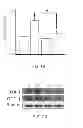 Fig. 12 - METHOD OF THERAPY AND DIAGNOSIS OF ATHEROSCLEROSIS