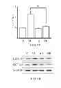 Fig. 16 - METHOD OF THERAPY AND DIAGNOSIS OF ATHEROSCLEROSIS